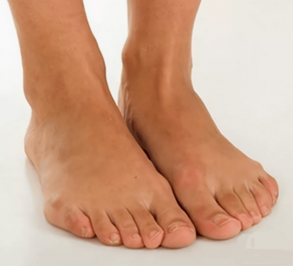 Picioare sănătoase după tratamentul cu spray Hondrox