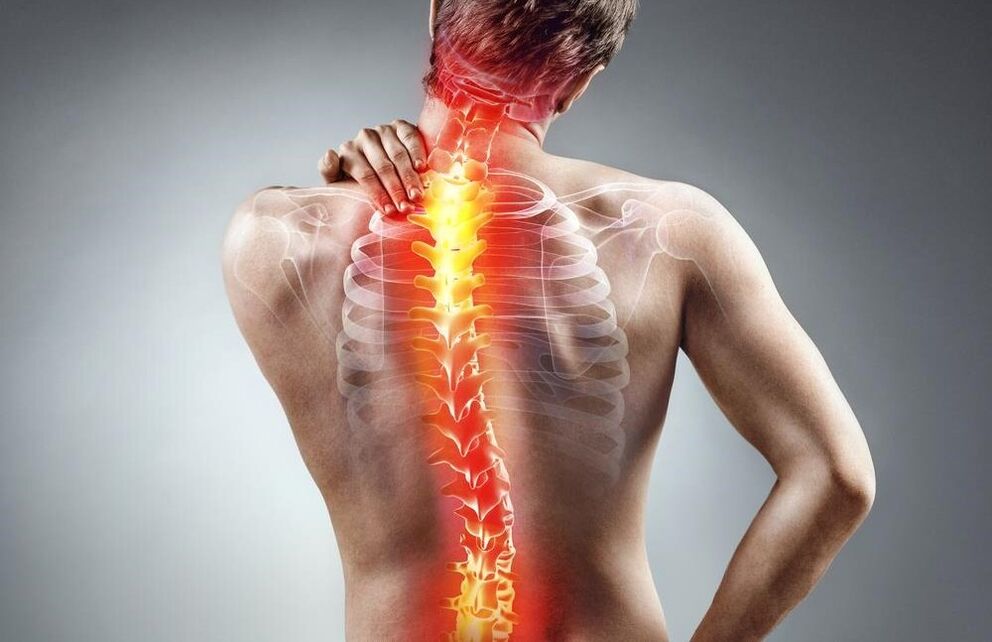 doare spatele cu osteocondroză