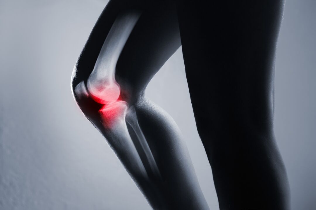 inflamația articulației genunchiului cu artroză