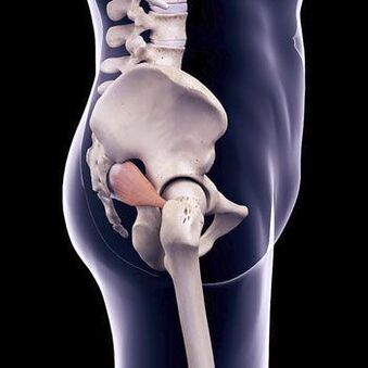 Durerea de spate cu pumnal poate fi cauzată de spasmul mușchiului piriform