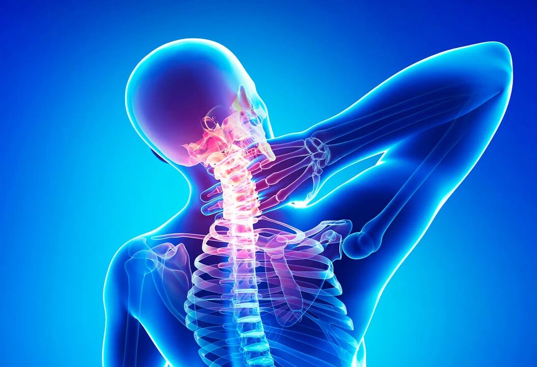 Osteocondroza coloanei vertebrale este o boală comună care necesită tratament. 