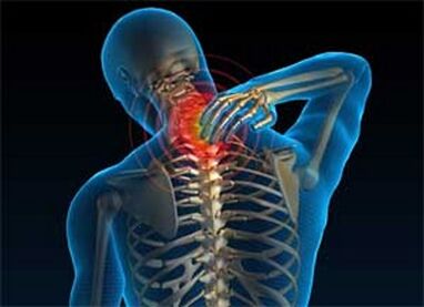Durerea la gât este un simptom frecvent al osteochondrozei