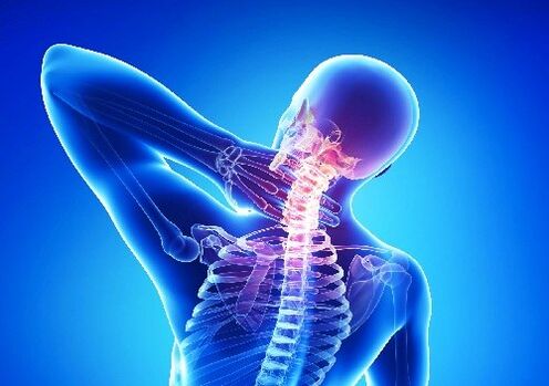 osteocondroza cervicală